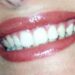 Dentista senza prenotazione a Roma, all’Isola Tiberina visite immediate per urgenze e controlli