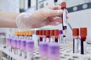 Test del sangue può escludere rischio demenza fino a 10 anni prima, lo studio