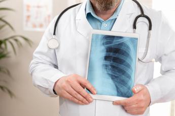 Cricelli (Simg), ‘al via primo studio dei medici di famiglia su Bpco’