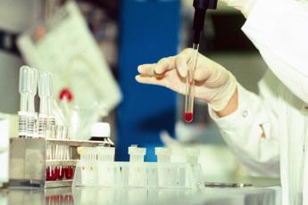 Fattore Pf4 elisir antinvecchiamento, Fondazione Artemisia in prima linea