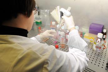 Linfomi aggressivi, ok Ue a primo anticorpo bispecifico