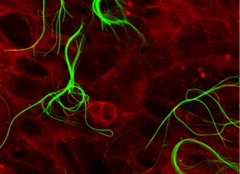 Ricerca: nanomateriali per rigenerare tessuti, italiani aprono nuove prospettive