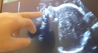 Ricerca, in gravidanza stress e smog influiscono su salute bebè, studio Pavia