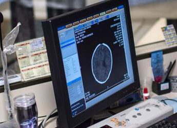 Tumori, codice a barre genetico traccia cellule cancro cervello: studio italiano