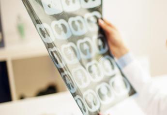 Ainmo, ‘nuova terapia per neuromielite ottica cambia qualità vita pazienti’