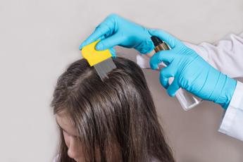 Pidocchi in azione anche al mare, “così si rischiano più casi a scuola”