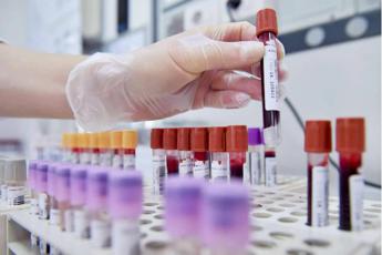 Anemia Fanconi, scoperta ‘firma molecolare’ per diagnosi più rapida