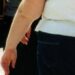 Una morte per malattie infettive su 10 è legata all’obesità, lo studio