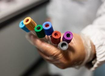 Svelare l’Alzheimer 15 anni prima dei sintomi, la speranza in un esame del sangue