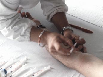 Allergia al nickel in aumento, l’immunologo “nuoce al 10% della popolazione”