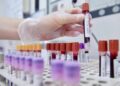 Hiv, dalla Sicilia il modello per estendere terapie long acting