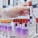 Hiv, dalla Sicilia il modello per estendere terapie long acting