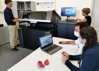 Medicina, milza su misura con stampa 3D per pianificare intervento