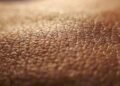 Dermatite atopica, quando la pelle condiziona la vita, ‘Diari atipici’ dà voce ai pazienti