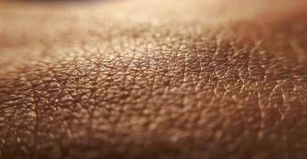 Dermatite atopica, quando la pelle condiziona la vita, ‘Diari atipici’ dà voce ai pazienti