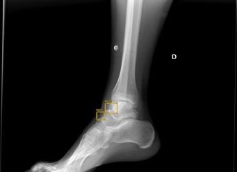 ‘Ai radiologo’ al San Camillo di Roma, diagnosi con l’assistente virtuale