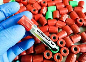 Studio, aggiunta di acido bempedoico riduce in modo efficace colesterolo Ldl