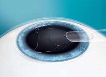 “Libertà visiva – Un nuovo modo di vedere il mondo”