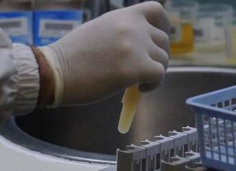 Malattia misteriosa Congo, Rezza: “Letalità alta ma non c’è allerta globale”