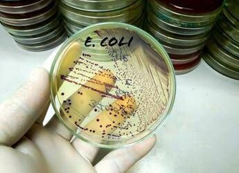 Da salmonella a listeria a E.Coli, ipotesi in campo in tossinfezioni alimentari