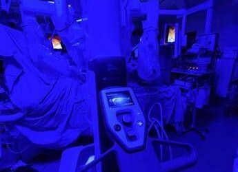 Chirurgia, all’Ismett di Palermo bypass aorto coronarico con robot, primo al Sud