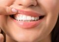 Denti a rischio tra i giovani, Sidp: “Il 36% della Gen Z ha gengive che sanguinano”