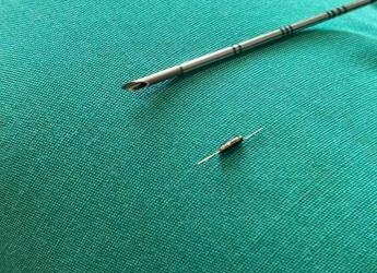 Dagli Usa in Italia, al San Camillo di Roma dispositivo ‘hi-tech’ per la chirurgia oncologica di precisione