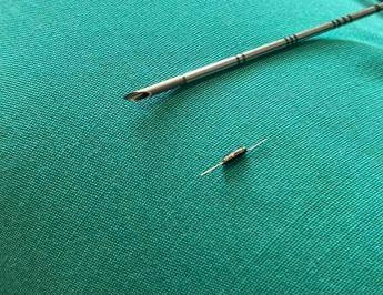 Dagli Usa in Italia, al San Camillo di Roma dispositivo ‘hi-tech’ per la chirurgia oncologica di precisione