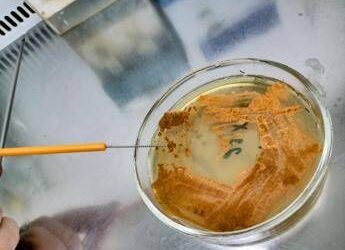 UnInsubria, scoperto nuovo antibiotico contro superbatteri