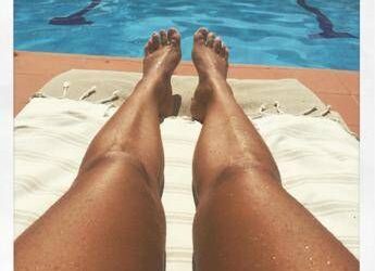 Abbronzarsi con la vitiligine, le regole del sole sicuro