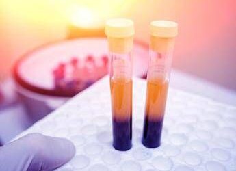 Farmaci, Sava (Sif Magazine): “In plasmaderivati attenzione particolare a sicurezza”