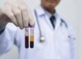 Ricerca, allo studio analisi sangue a casa e test cerebrali online per scoprire rischio demenza