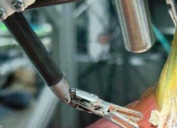 Il ‘dottor robot’ opera da solo, primo intervento senza aiuto umano