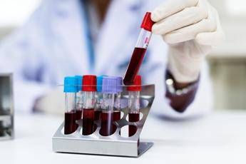 Aviaria, cos’è il virus H9N2: come si trasmette e i rischi per l’uomo