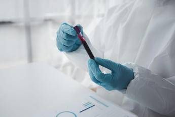 Epatite A in forte crescita in Italia: Lazio, Campania e Puglia le regioni con più casi