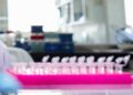 Milano, focolaio di tubercolosi all’Istituto di Medicina legale: 8 casi conclamati e 7 positivi. Indagini sull’origine del contagio