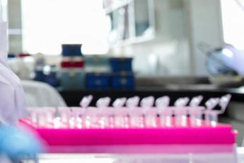 Milano, focolaio di tubercolosi all’Istituto di Medicina legale: 8 casi conclamati e 7 positivi. Indagini sull’origine del contagio