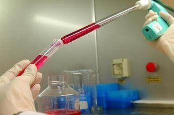 Melanoma uveale metastatico: “Tebentafusp raddoppia sopravvivenza a 5 anni”