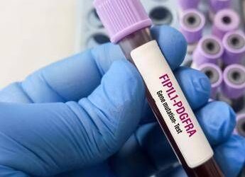 Giornata patologie eosinofile, allergologo Caminati: “Diagnosi complessa”