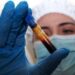 Hantavirus, negativo il turista inglese in quarantena a Milano. Test per una donna ricoverata a Messina
