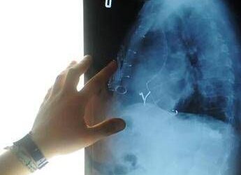 Radiologia interventistica, Ssn e fondazioni per cure più accessibili