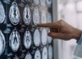 Centro Dbs Pavia, 100 interventi di neurostimolazione profonda per Parkinson