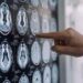 Salute, 300mila persone in Italia con Parkinson, 10% ha diagnosi prima dei 50 anni