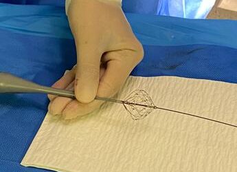 Fibrillazione atriale, Aou Marche: “Prima volta in Italia ablazione con catetere a campo pulsato”