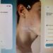 Ai prescrive farmaci contro l’acne, esperti Siiam: “Progresso in Medicina non si misura dal numero di decisioni automatizzate, ma dai benefici concreti per i pazienti”