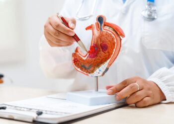 Cancro allo stomaco avanzato, nuova terapia riduce del 42% il rischio di morte ﻿
